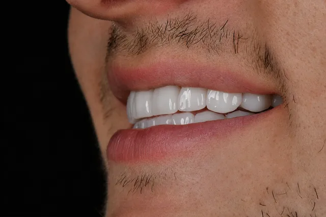 Zirkoniumkronen 5